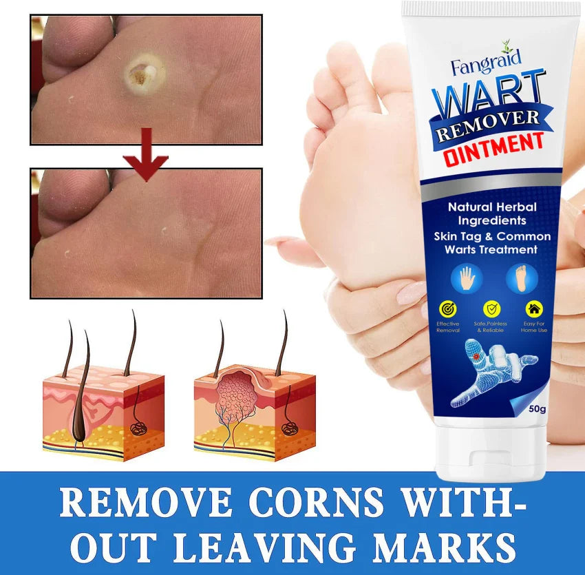 Fast-Acting Wart Remover – Made in India (Pack of 2)